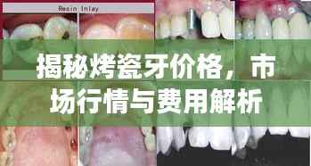 揭秘烤瓷牙价格,市场行情与费用解析