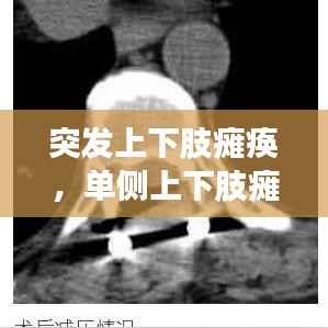 突发上下肢瘫痪,单侧上下肢瘫痪