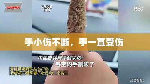 手小伤不断,手一直受伤